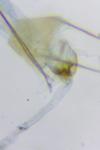 Pexicopia malvella