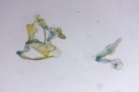 Coleophora amellivora