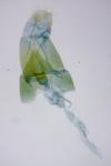 Agdistis satanas