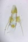 Metzneria hilarella