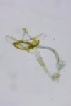Coleophora versurella