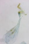 Parornix torquillella