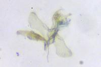 Coptotriche angusticollella