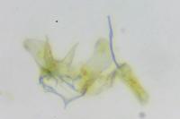 Coptotriche angusticollella