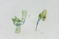 Coptotriche marginea