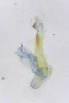 Oxyptilus distans