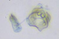 Ectoedemia