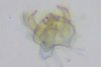 Ectoedemia
