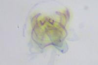 Ectoedemia