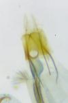 Coleophora glaucicolella