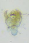 Ectoedemia