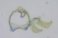 Ectoedemia