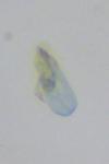 Ectoedemia