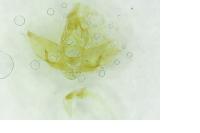 Agonopterix scopariella