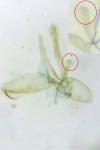 Phyllonorycter
