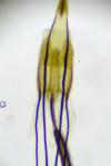 Coleophora deauratella
