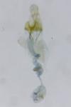 Coleophora texanella