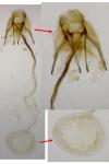 Coleophora caelebipennella