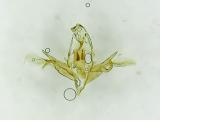 Symmocoides oxybiella