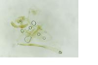 Argyresthia spinosella