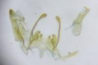 Scrobipalpa