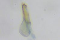 Scrobipalpa