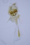 Cnephasia communana
