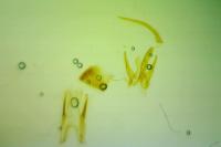 Teleiopsis diffinis