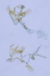 Coleophora taeniipennella