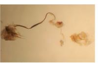 Coleophora albicosta