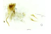 Stenoptilia bipunctidactyla