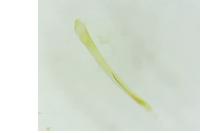 Argyresthia spinosella