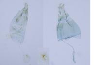Phyllonorycter platani