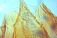 Acleris aspersana