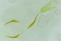Stenoptilia bipunctidactyla