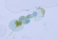 Stigmella eberhardi