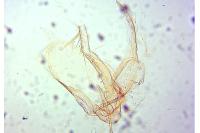 Phyllonorycter
