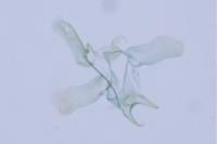 Coptotriche angusticollella