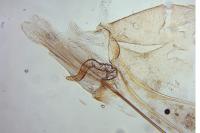 Infurcitinea albicomella