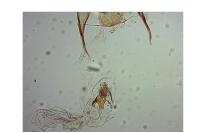 Coleophora avellanae