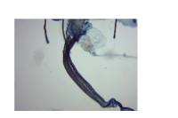Coleophora striatipennella
