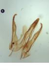 Teleiopsis diffinis