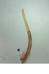 Teleiopsis diffinis