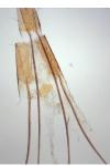 Metzneria neuropterella