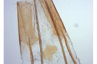 Metzneria neuropterella