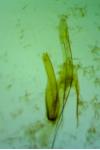 Teleiopsis diffinis