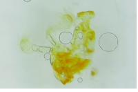 Endothenia ustulana