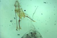 Zeiraphera rufimitrana
