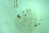 Zeiraphera rufimitrana