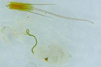 Blastobasis glandulella